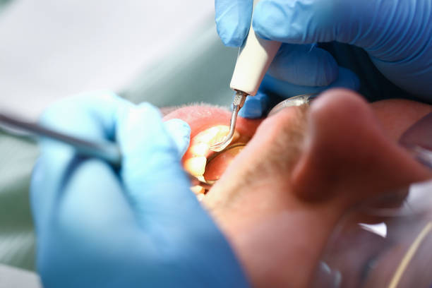 Best Emergency Dental Care for Sports Injuries in Constantine, MI
