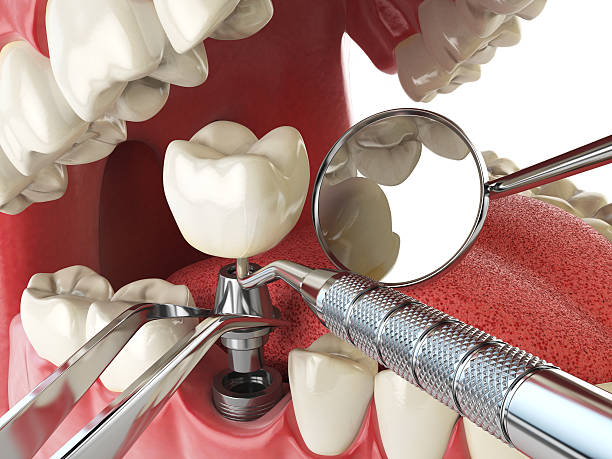 Best Emergency Denture Repair in Constantine, MI